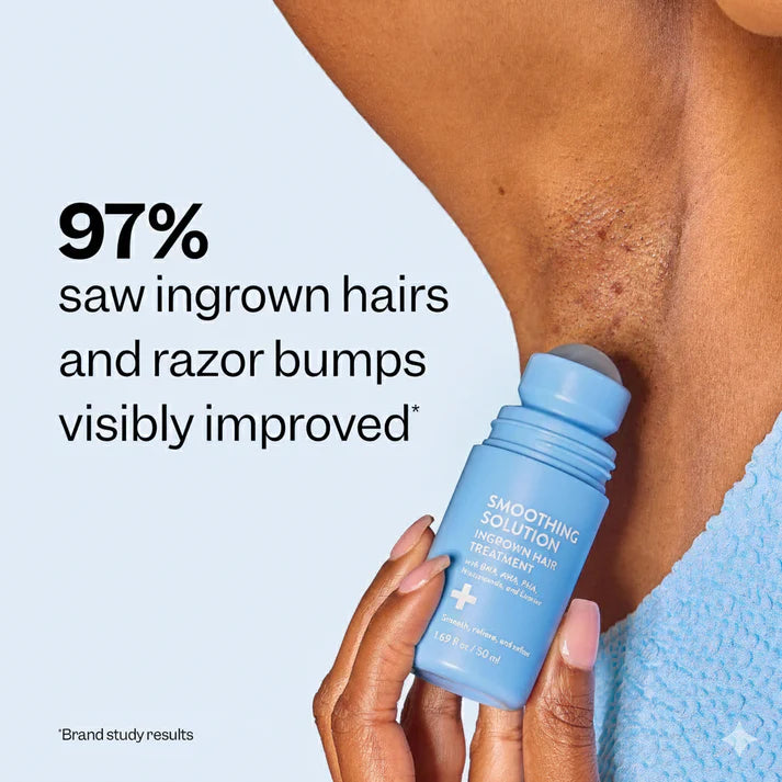 Soothing Solution - Ingrown Hairs Solution
